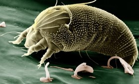 Hausstaub Allergie-Milben EX